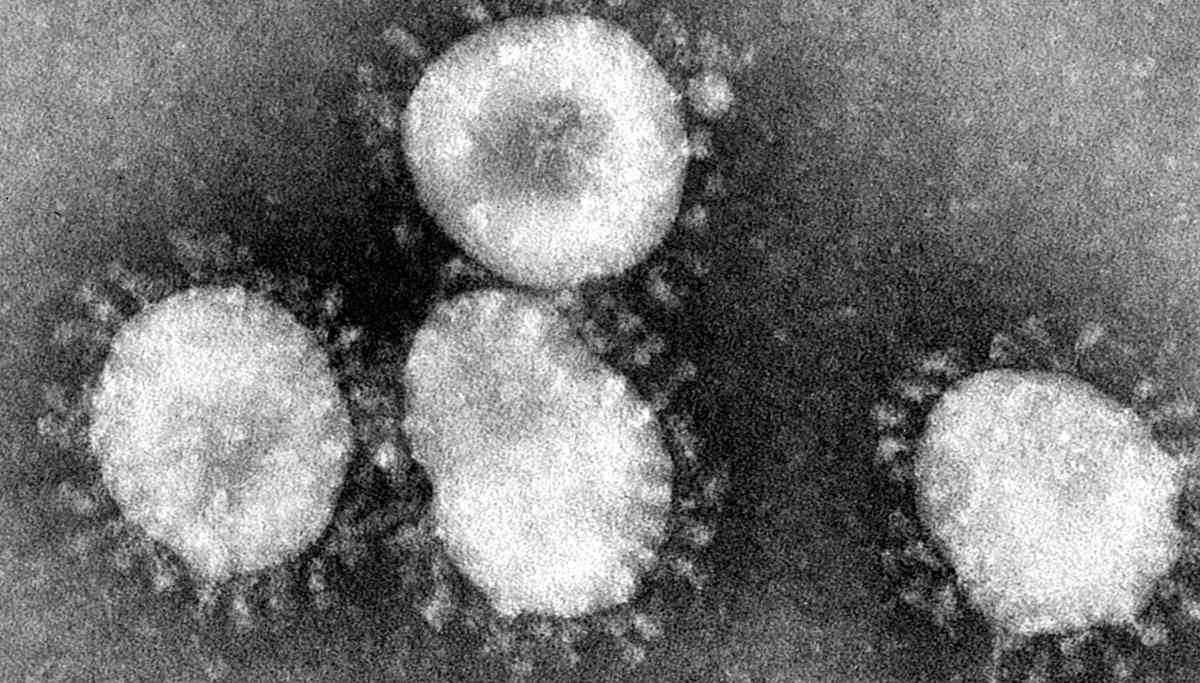First Death occurred in Tamil Nadu due to Coronavirus